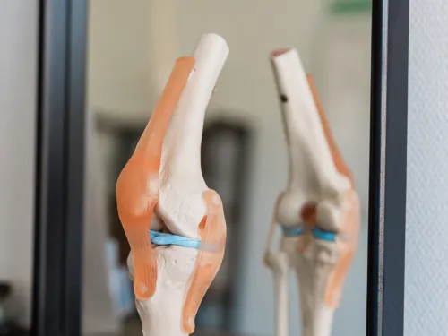 Ein Bild sagt mehr als tausend Worte – 
mit anatomischen Modellen erklärt Katharina 
verständlich, was im Knie passiert und 
warum gezielte Anwendung so wichtig ist.